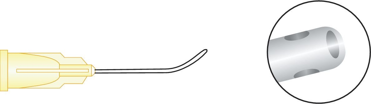Subtenon's Anesthesia Cannula (Triport) (Angled)